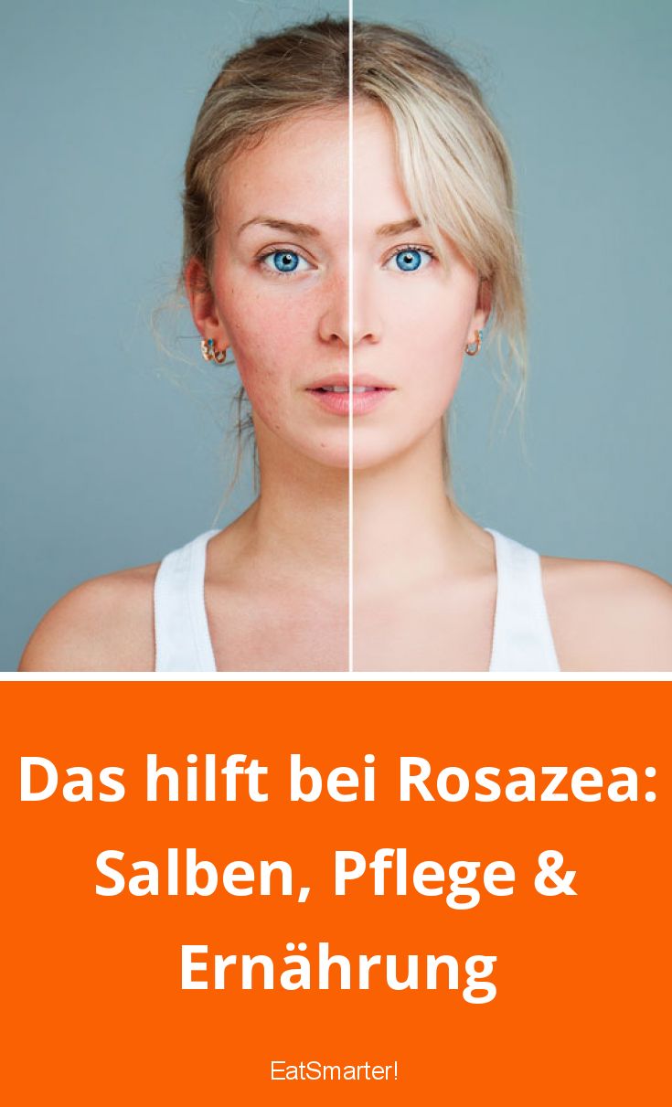 Das hilft bei Rosazea: Salben, Pflege & Ernährung | EAT SMARTER