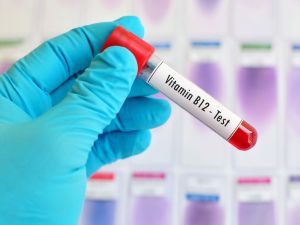 Wie entsteht ein Vitamin-B12-Mangel und was kann man dagegen tun?
